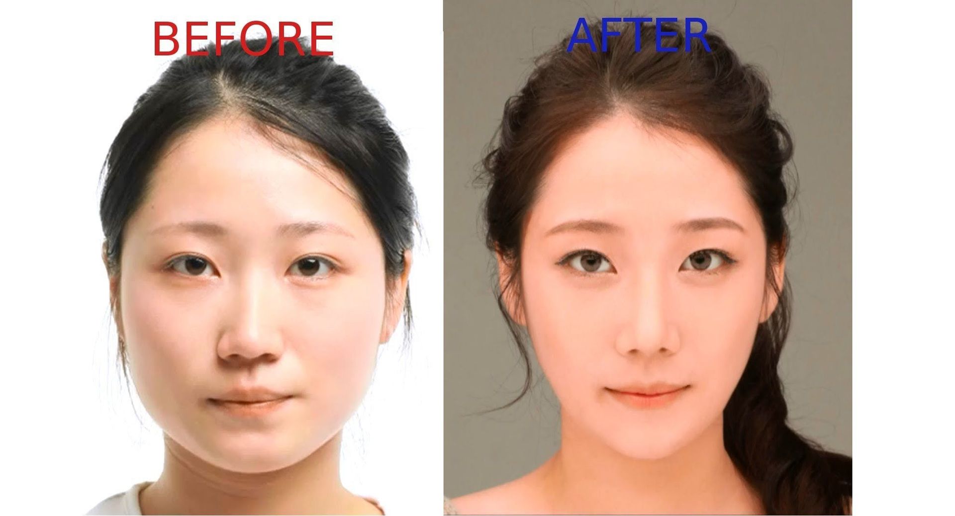 Most Popular Plastic Surgery Procedures In Korea