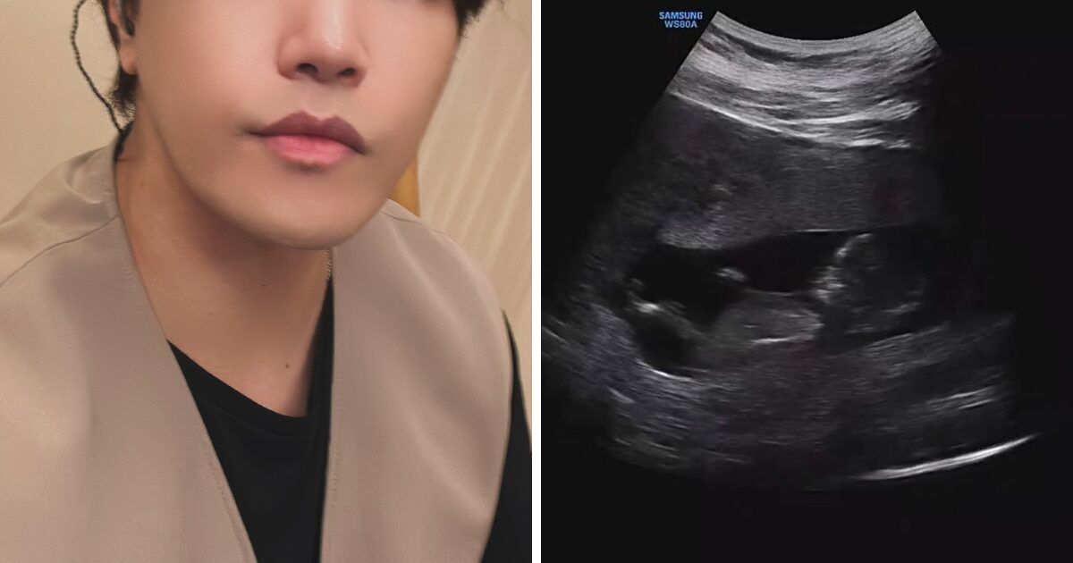 Korean singer surprises fans with pregnancy announcement just 3 months after wedding
