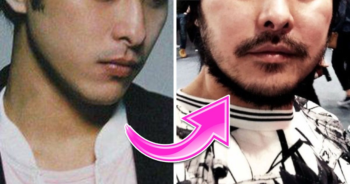 Handsome Actor Who Fell From Grace Is Unrecognizable Now