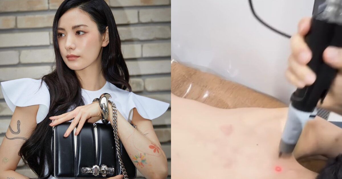 Actress Nana Bares All In Vlog About Tattoo Removal