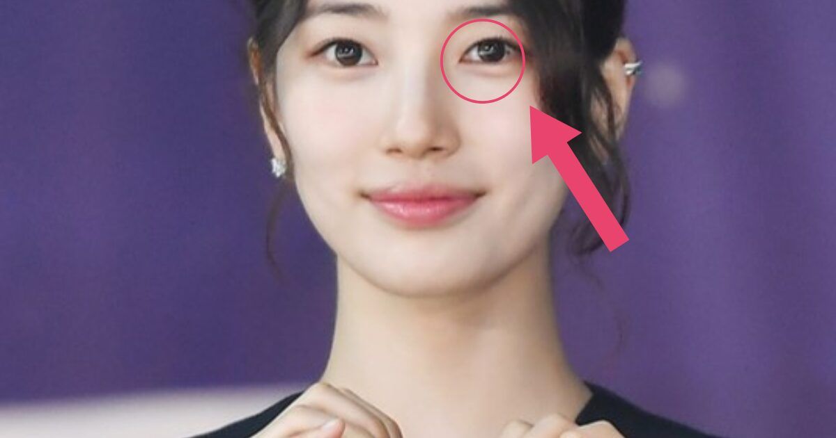 Suzy Undergoes Cosmetic Procedure On Her Eyeball