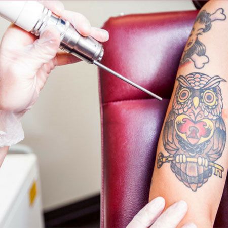 24-Year-Old Undergoes Painful Cosmetic Procedures To Land A Job 4 Rejuvi-Tattoo-Removal-Training-1- hd beauty academy