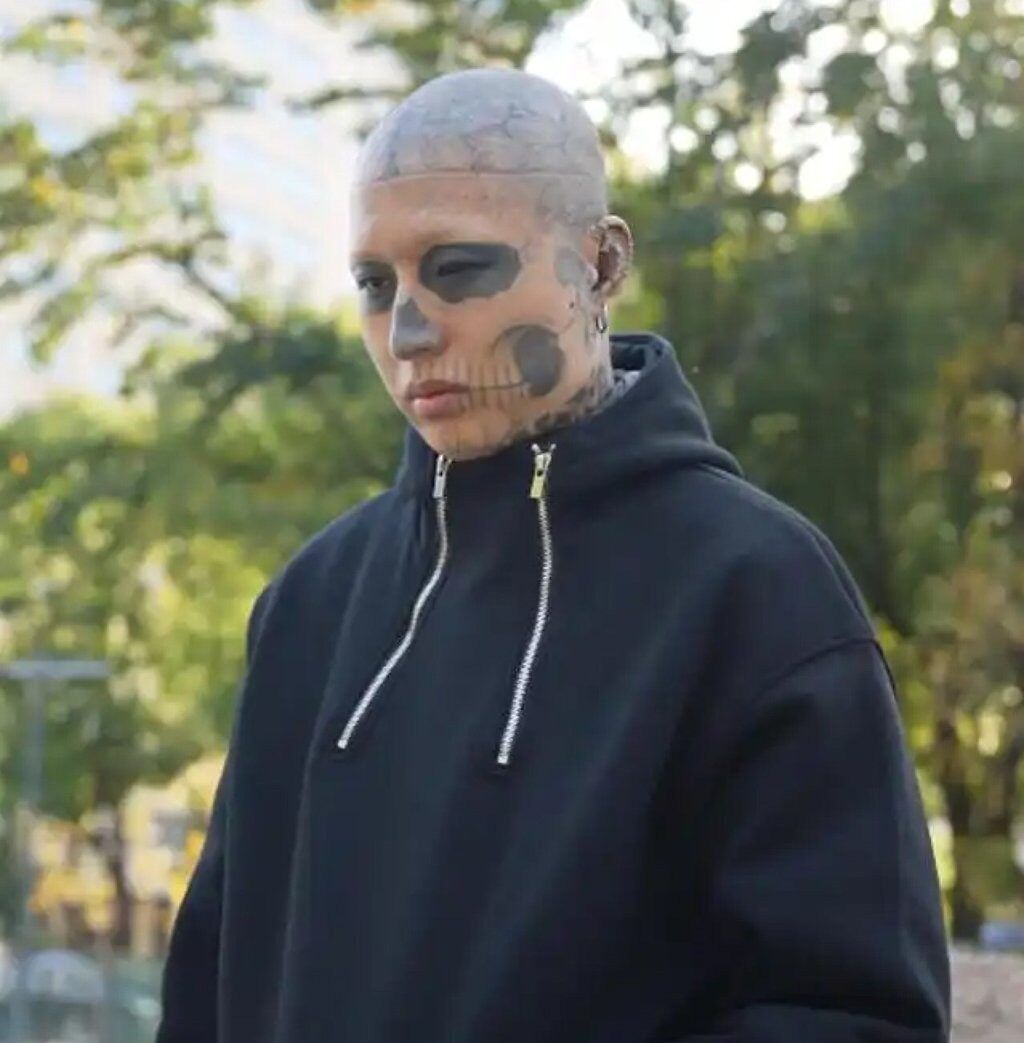 24-Year-Old Undergoes Painful Cosmetic Procedures To Land A Job 5 b065e7c6-f92f-431e-8cb5-f49096c9
