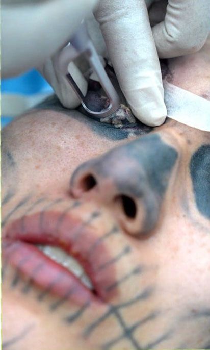 24-Year-Old Undergoes Painful Cosmetic Procedures To Land A Job 7 china