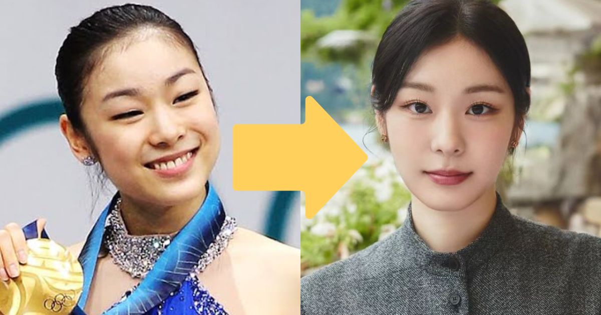 K-Netizen Defends Kim Yuna From Double Eyelid Surgery Accusations With ...