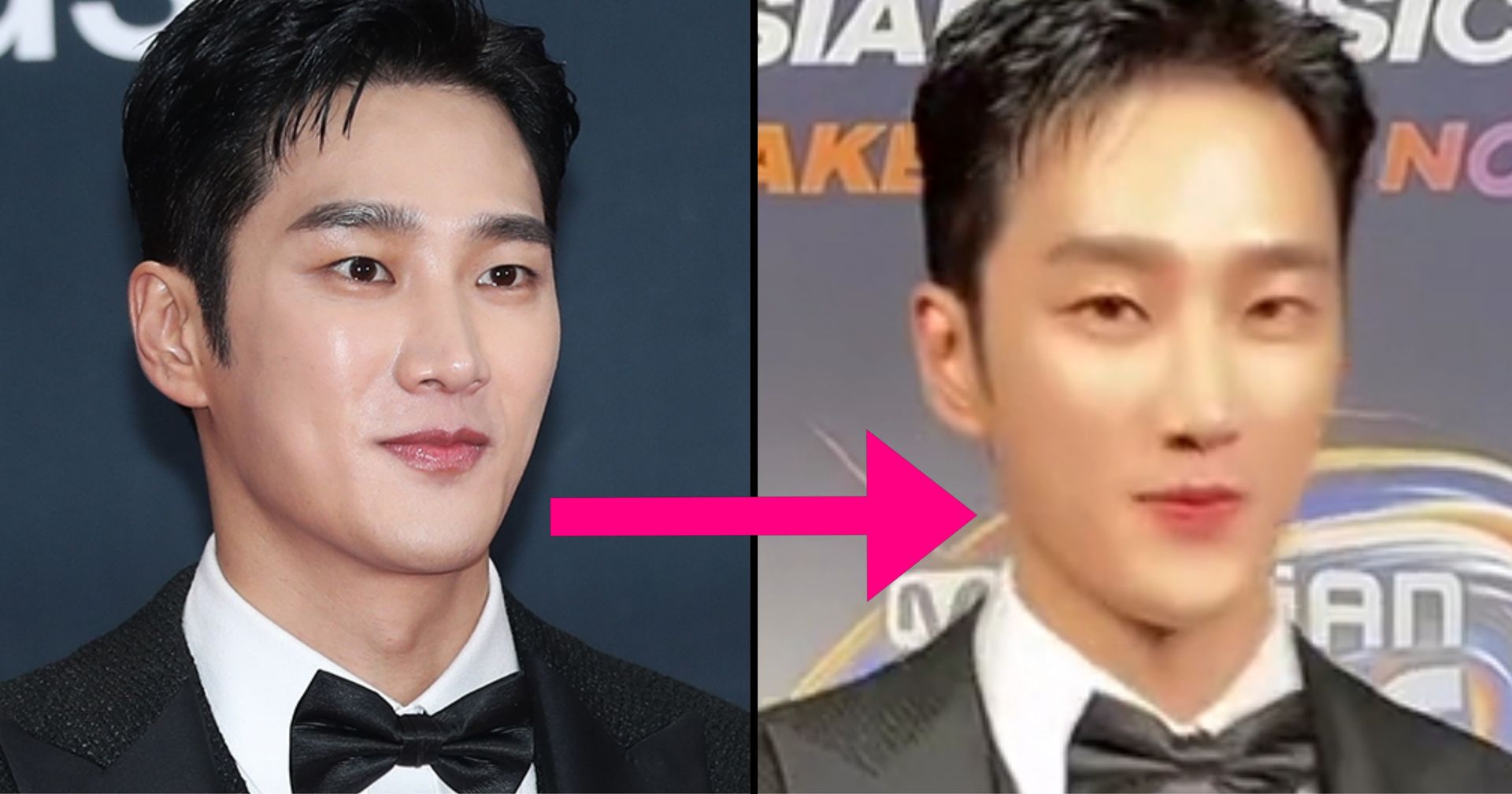 Netizens Call Out Mnet For Using A Beauty Filter On Ahn Bo Hyun And ...