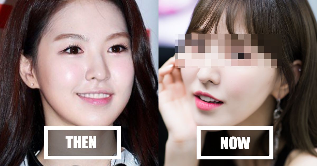 Netizens Accuse Red Velvet's Wendy Of Double Eyelid Surgery