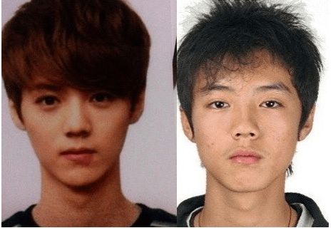 EXO plastic surgery