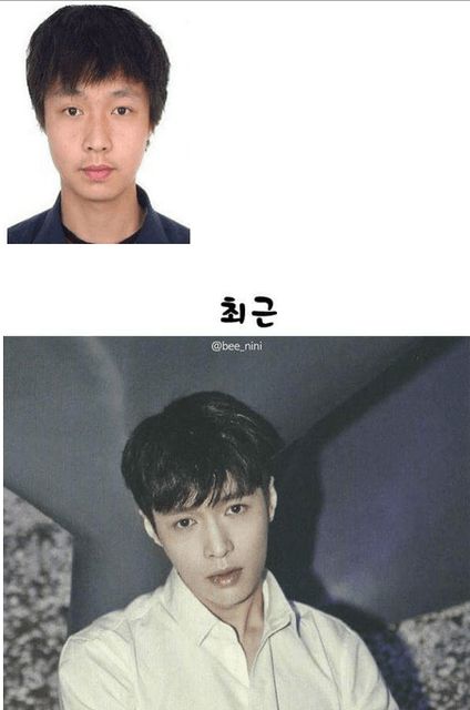 EXO plastic surgery