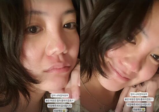 Go Eun Ah Sebelum Cedera