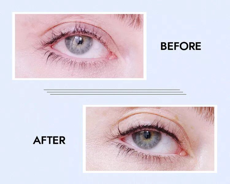 eyelash-before-after-forHolly-21dd1ffaa19345279377a7b77e2806ac