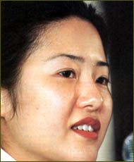 Chung Yong Jin, suami Ko Hyun Jung.