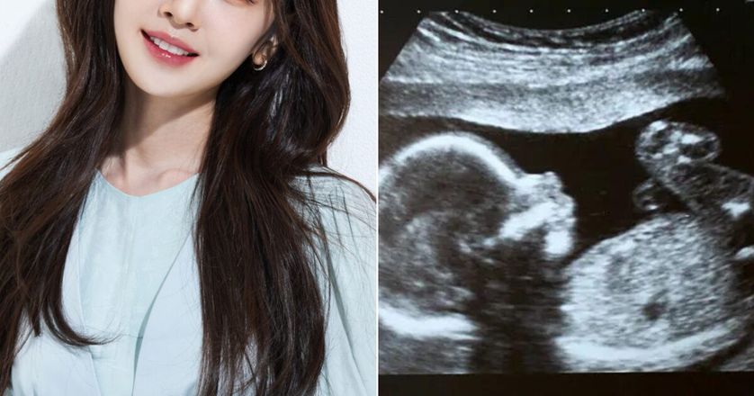 Beautiful Actress Makes Surprise Pregnancy Announcement